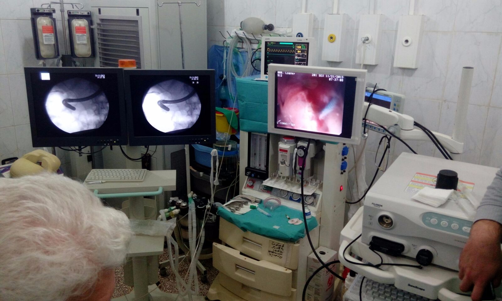 GI_Endoscopy-28