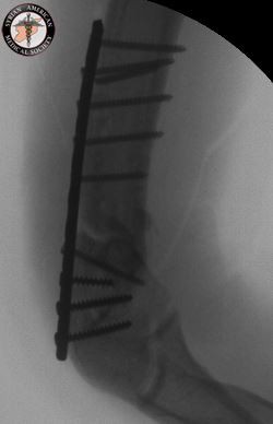 Idlib_Humerus_Break_August_17-29
