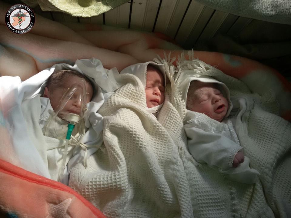 triplets-36